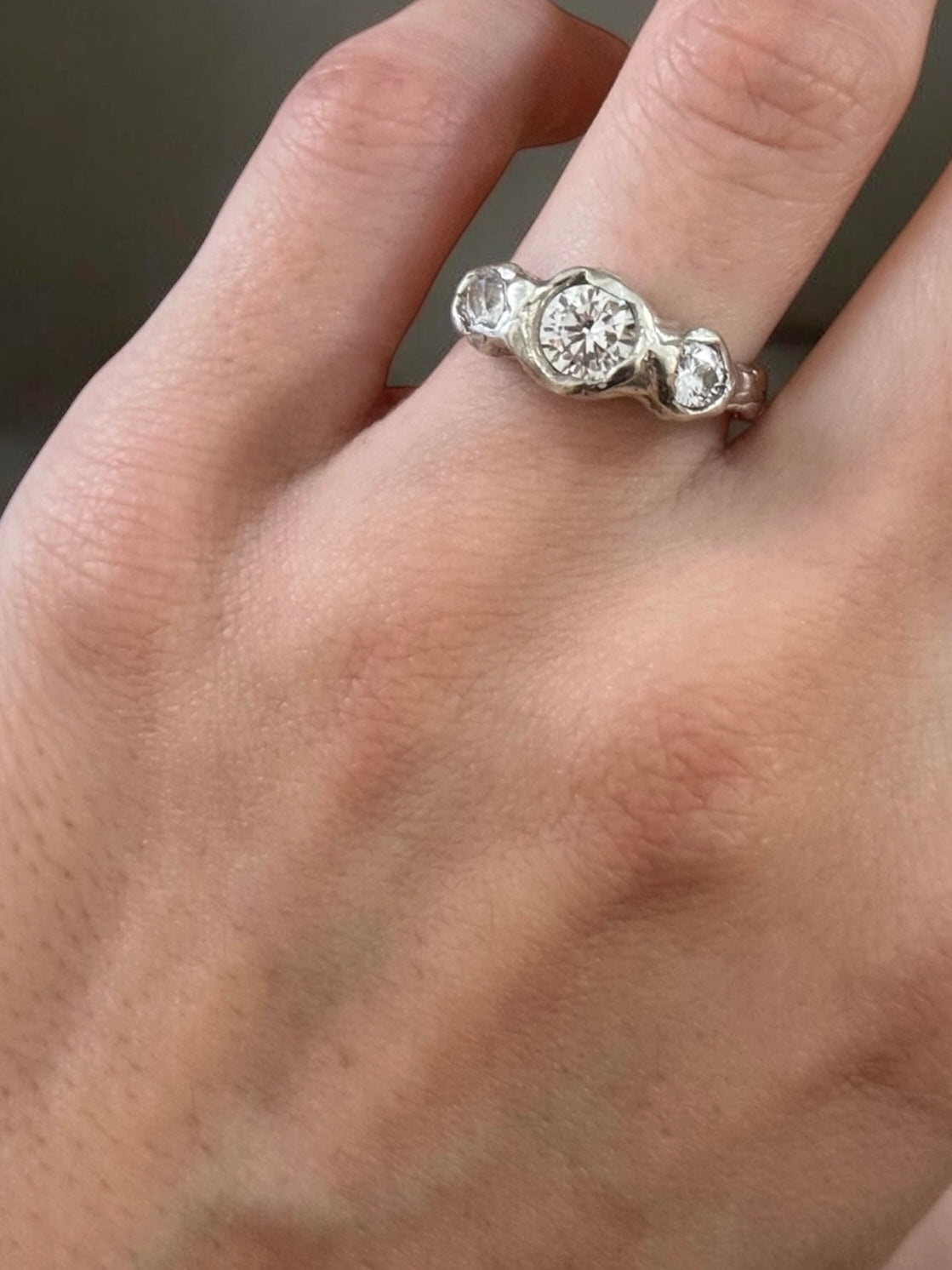 Nodo Ring